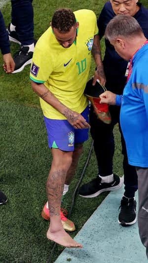 El tobillo de Neymar quedó así tras el encuentro.  REUTERS