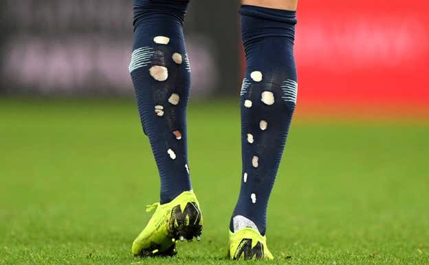 Las medias agujereadas de Kyle Walker en un partido con el Manchester City.  GETTY