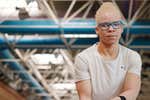 Adi Iglesias, la campeona paralímpica que acabó en un centro de menores español tras huir de la caza de los albinos en Mali