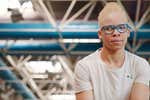 Adi Iglesias, la campeona que acabó en un centro de menores español tras huir de la caza de los albinos en Mali