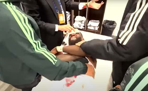 Segura, poniéndole una gasa en la cabeza ensangrentada de Rüdiger.  REALMADRIDTV