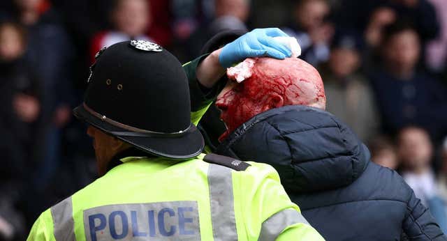 Un derbi ensangrentado en la FA Cup que estuvo parado media hora: «Déjalo morir…»