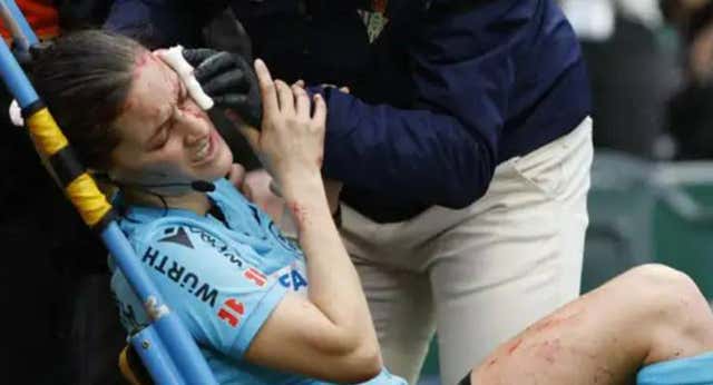 El shock de Guadalupe Porras tras chocar con un cámara: «No recuerdo nada de la jugada ni del partido; tuve que recurrir a profesionales»