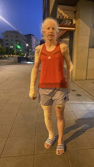 Susana Rodríguez, unos días después del accidente.  @srgacio