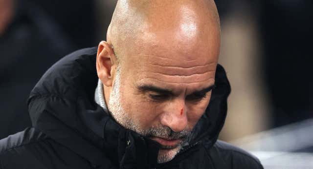 Las inquietantes heridas de Guardiola encierran algo más: “Quiero lesionarme a mí mismo”