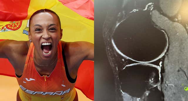 Sobrehumana: Ana Peleteiro ganó las medallas con una lesión en la tibia