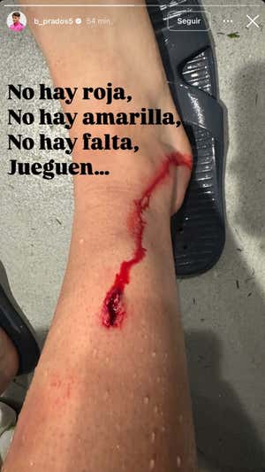 Imagen que Beñat Prados compartió en sus redes sociales.